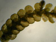 Cheilolejeunea clausa, microscopic view of rehydrated material from Allison 13131, with orbicular primary leaves and underleaves, the latter apically cleft