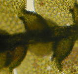 Cheilolejeunea clausa, microscopic view of rehydrated material from Allison 13131, lobules inflated and with constricted apex, a characteristic of the genus